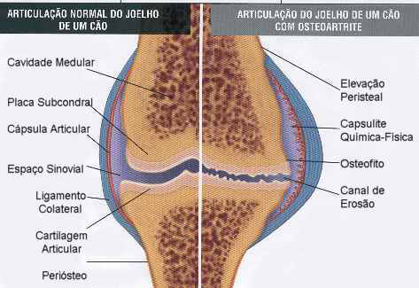 Redevet articulacao joelho
