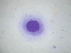 Redevet celulas parabasais revistavet