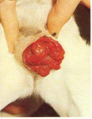 Redevet neoplasia vulvar transmissivel