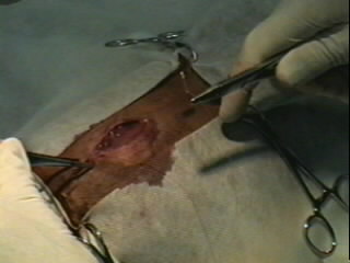 Redevet-Pneumotórax10