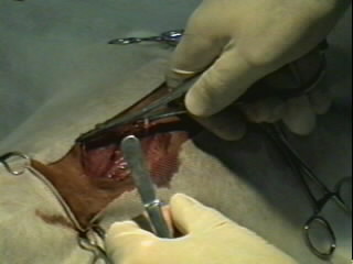 Redevet-Pneumotórax7