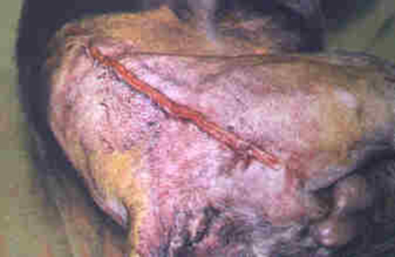 Redevet cirurgia caoxal6