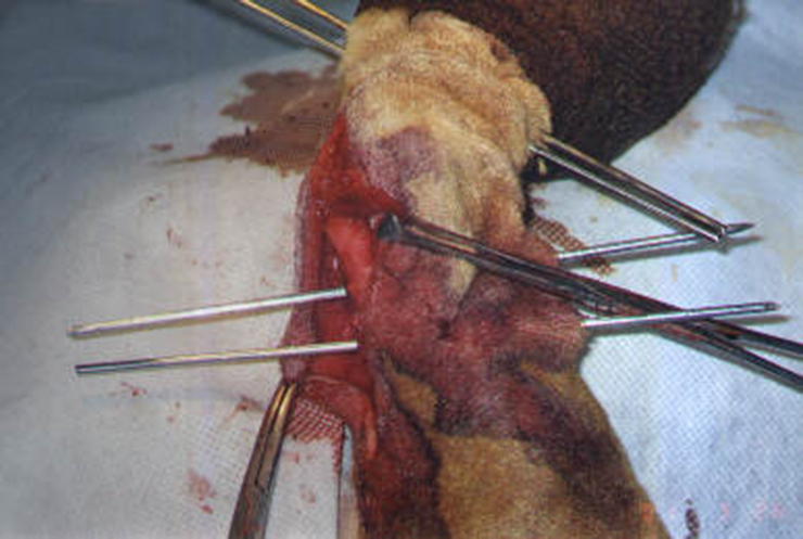 Redevet cirurgia radio ulna externo11