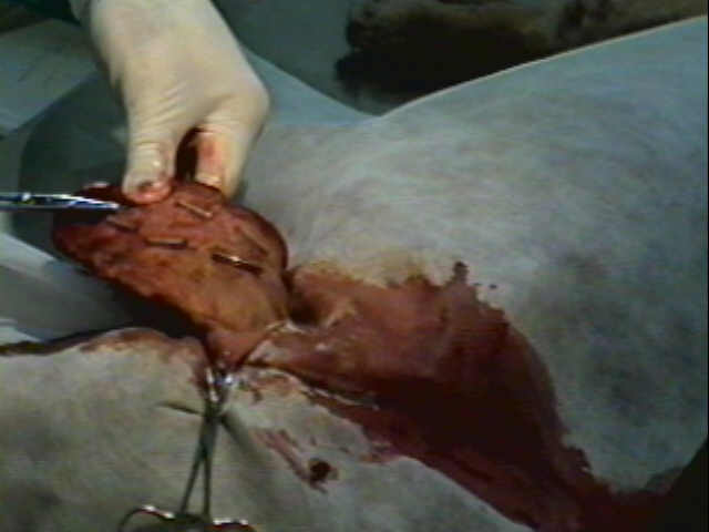 Redevet otohematoma12jpg