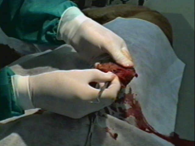 Redevet-otohematoma4