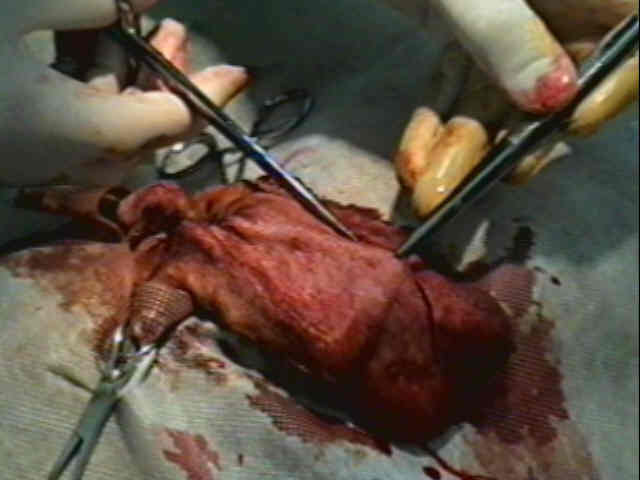 Redevet-otohematoma6