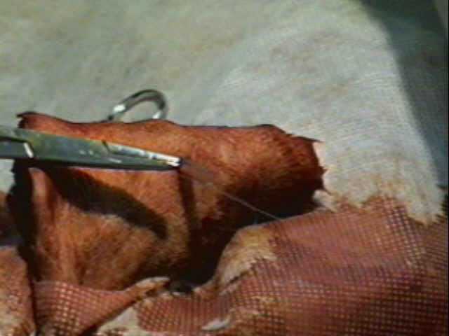 Redevet-otohematoma8