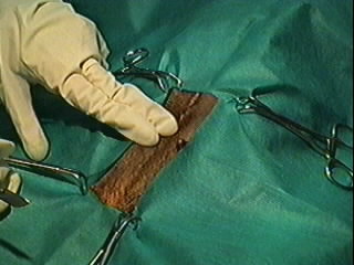 Redevet tecnica do gancho1