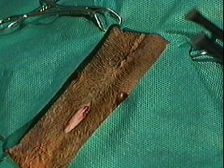 Redevet tecnica do gancho2